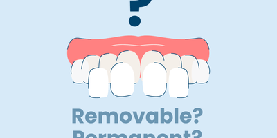 Are veneers permanent or removable??