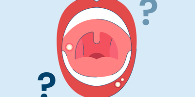 can you pop a canker sore