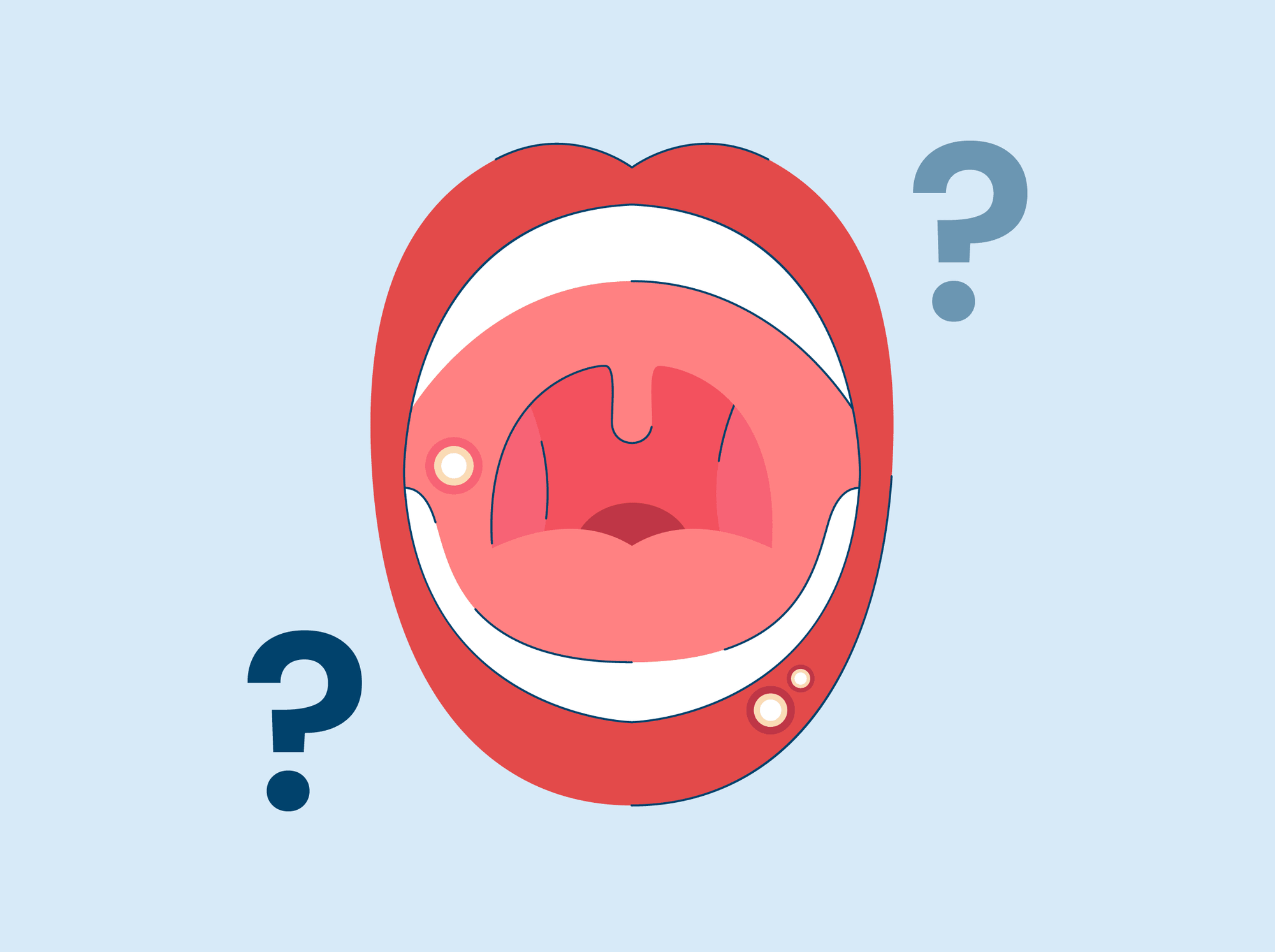 can you pop a canker sore