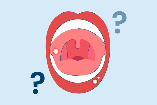can you pop a canker sore