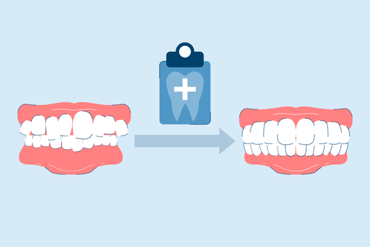 9 Ways to Get Crooked Teeth Fixed With Braces or Cosmetic Dentistry