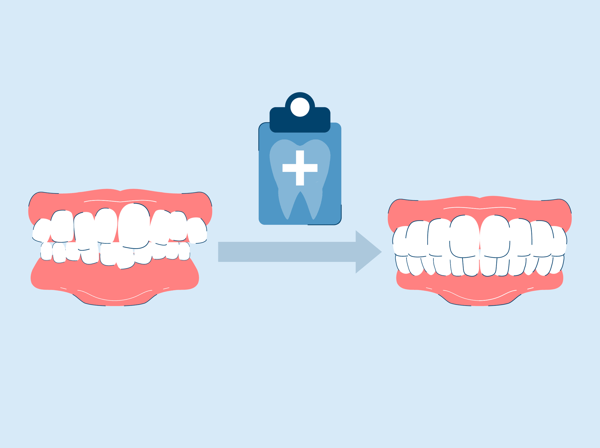 9 Ways to Get Crooked Teeth Fixed With Braces or Cosmetic Dentistry
