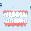 How Much Do Full Mouth Dental Implants Cost?
