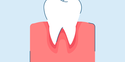 Gum Infection: Causes, Symptoms, and Treatment