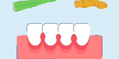 How to Get Rid of Gingivitis | Effective Home Remedies