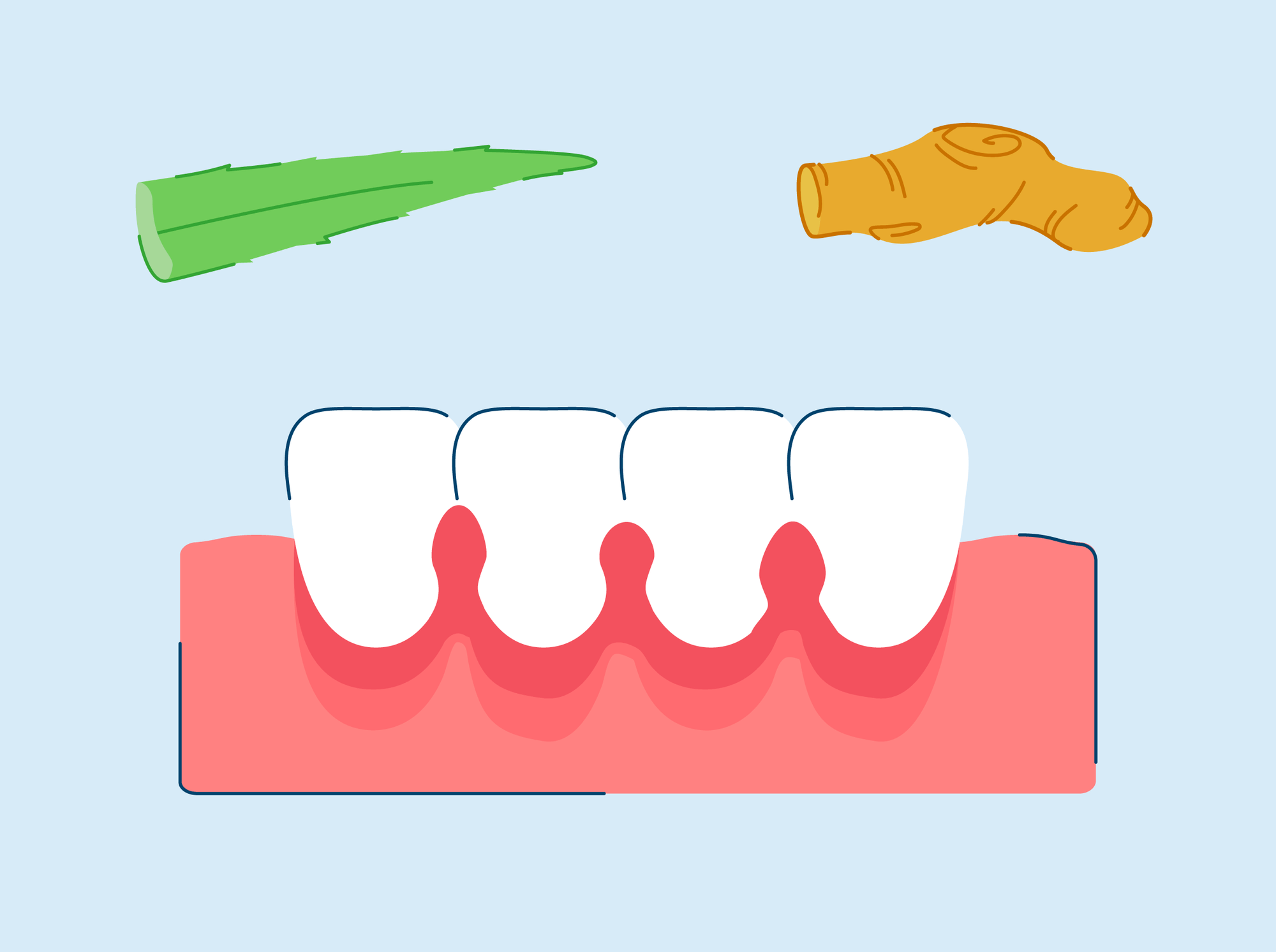 How to Get Rid of Gingivitis | Effective Home Remedies