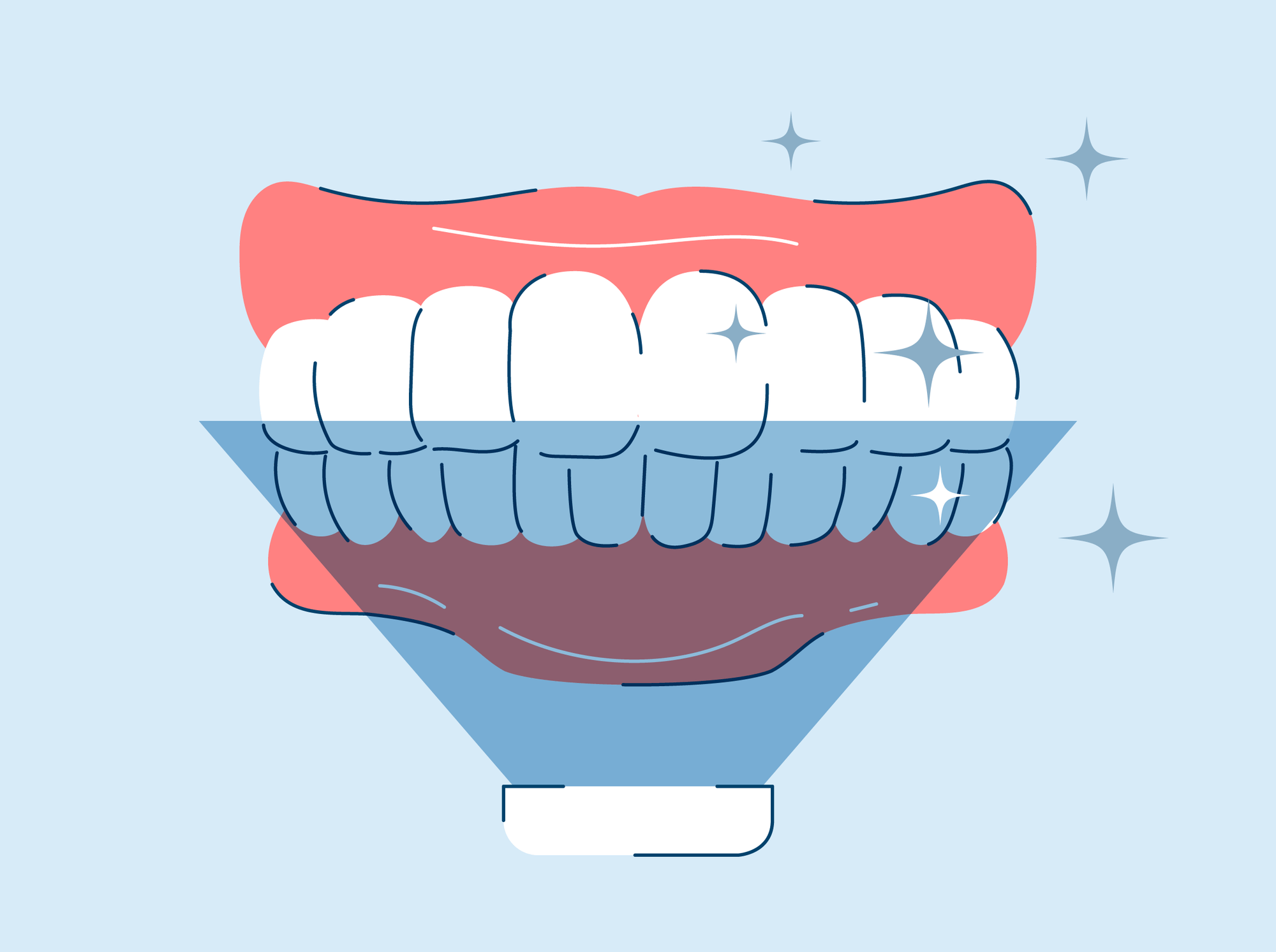 Is UV Teeth Whitening Safe?