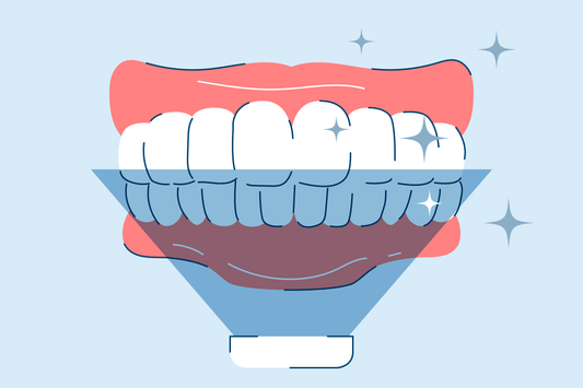 Is UV Teeth Whitening Safe?