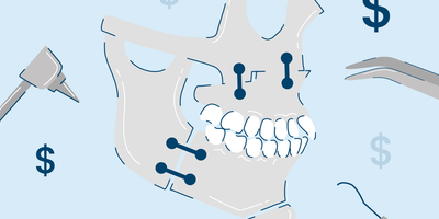 4 Types of Orthognathic Surgery: Procedure and Costs