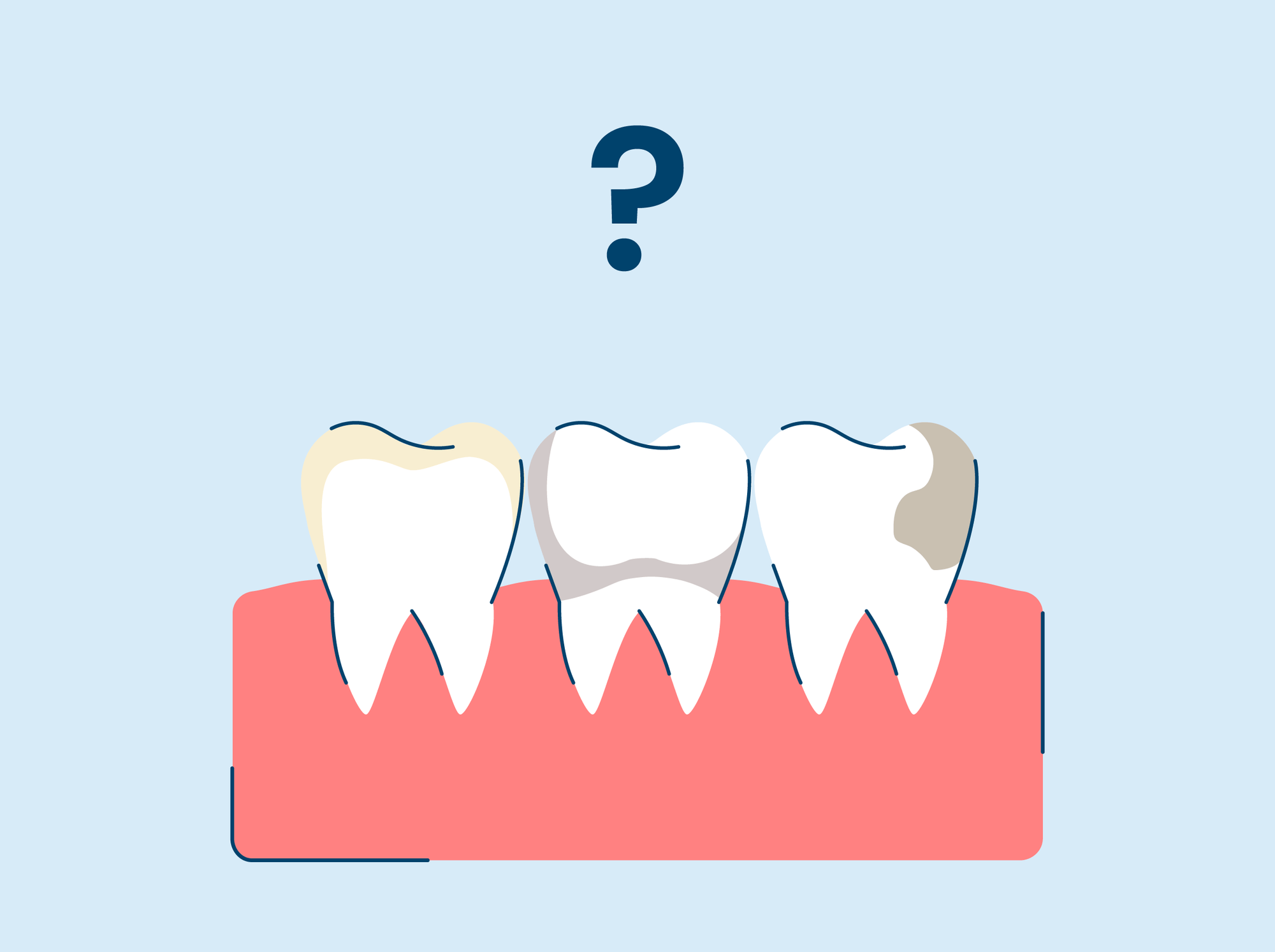 Stained Teeth: Causes and Ways to Treat Discoloration