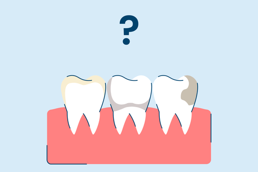 Stained Teeth: Causes and Ways to Treat Discoloration