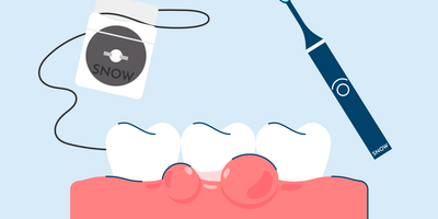 Swollen Gums: Causes, Treatment, and Prevention