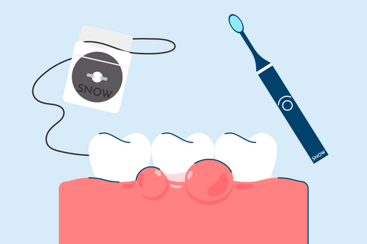 Swollen Gums: Causes, Treatment, and Prevention