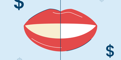 How Much Does Teeth Whitening Cost? A Comprehensive Price Guide