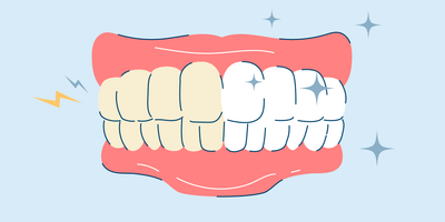 Teeth Whitening for Sensitive Teeth
