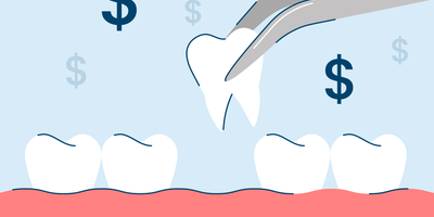 How Much Does A Tooth Extraction Cost?