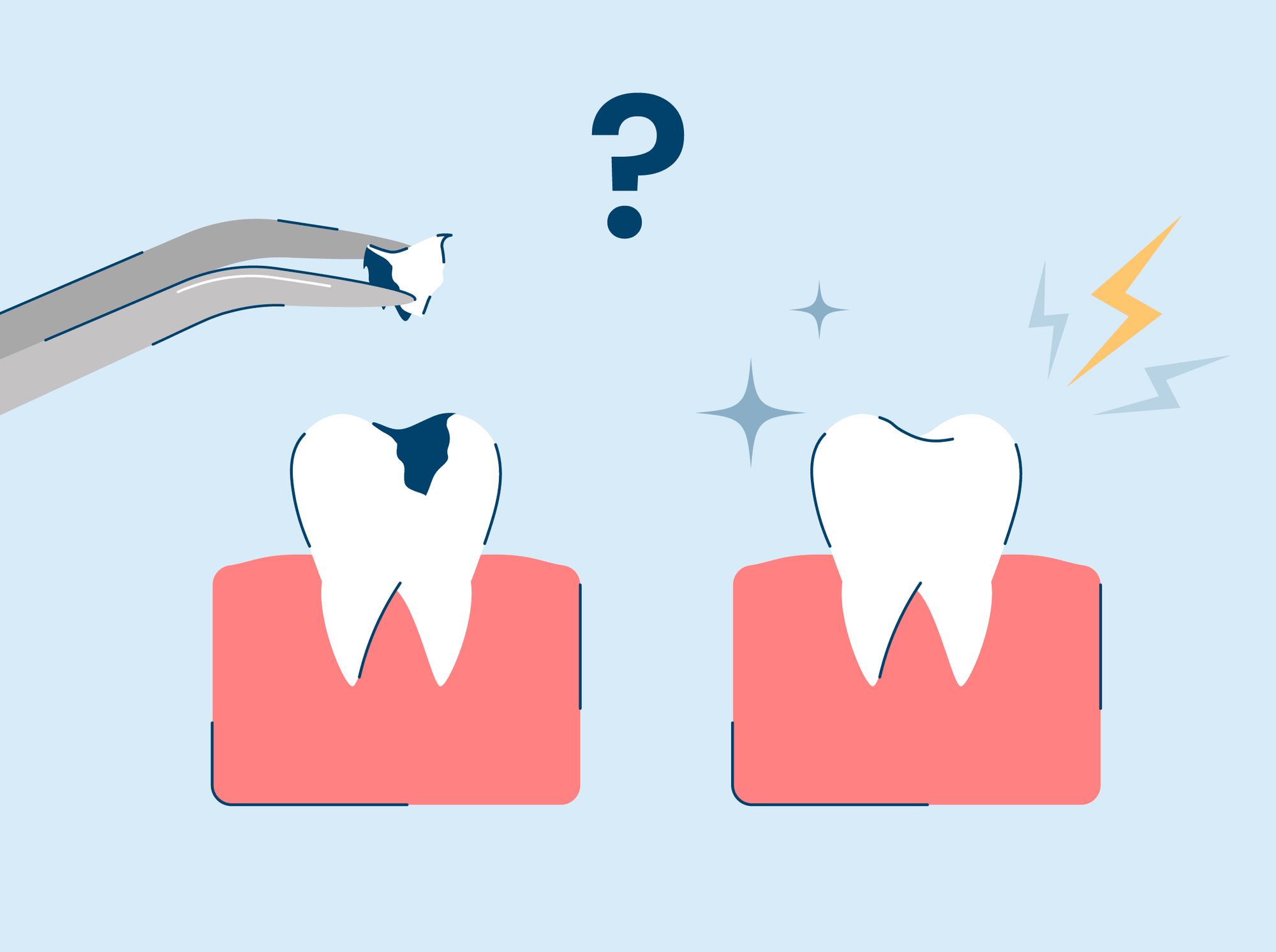 What to Do If You Have Tooth Sensitivity After a Filling?