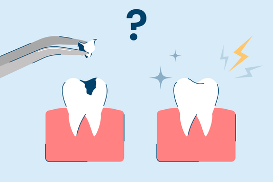 What to Do If You Have Tooth Sensitivity After a Filling?