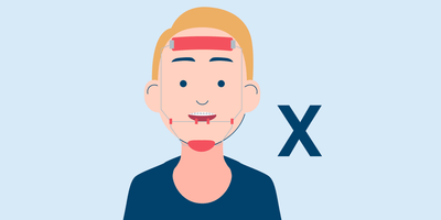 3 Types of Orthodontic Headgear for Underbite