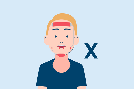 3 Types of Orthodontic Headgear for Underbite
