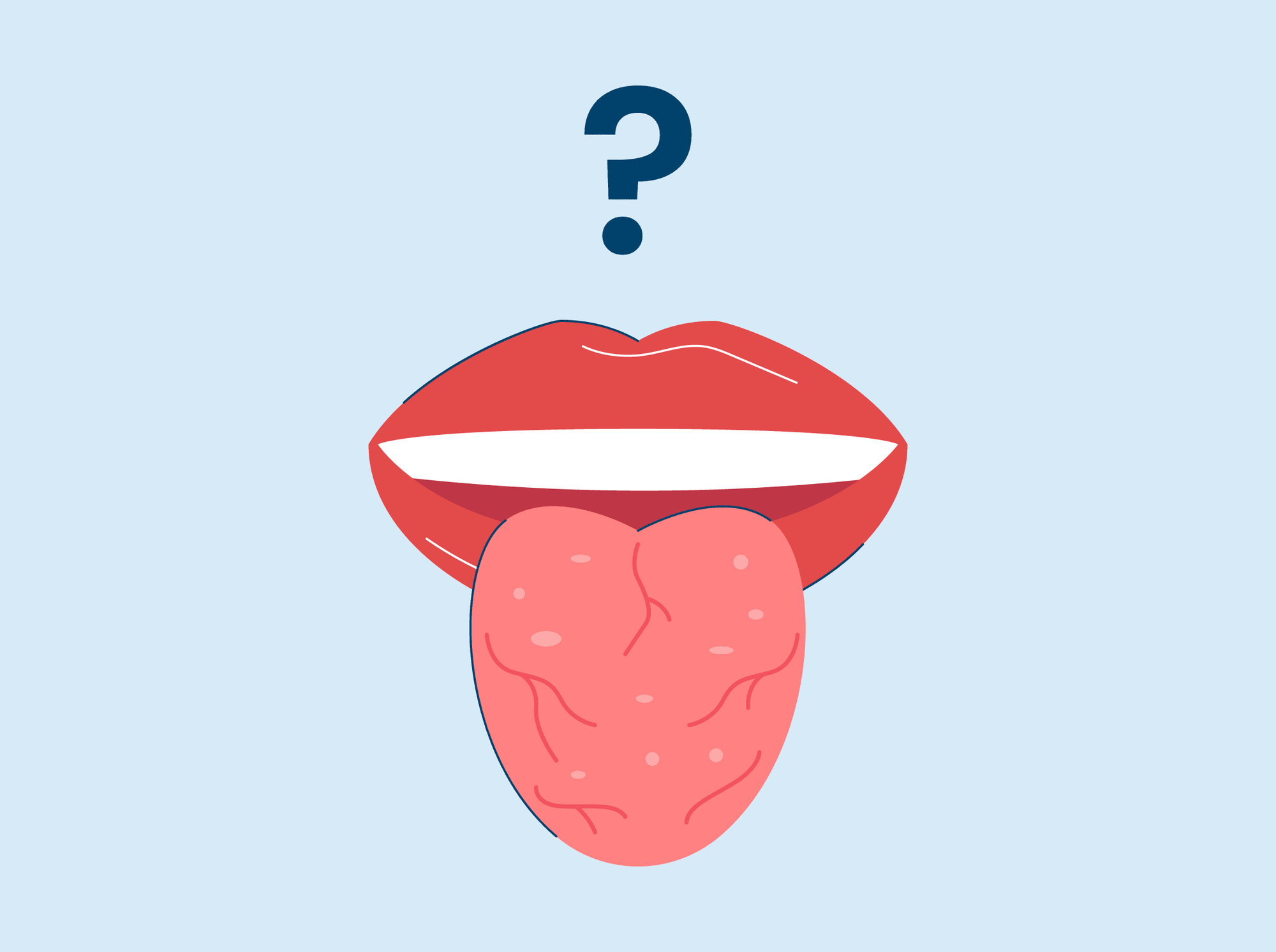 What Is a Fissured Tongue?