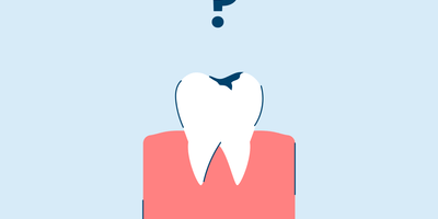 What to Do When You Have a Hole in Your Tooth