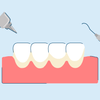 What Causes Tartar on Teeth?