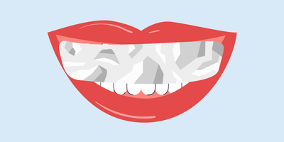 Is Aluminum Foil Teeth Whitening Safe?