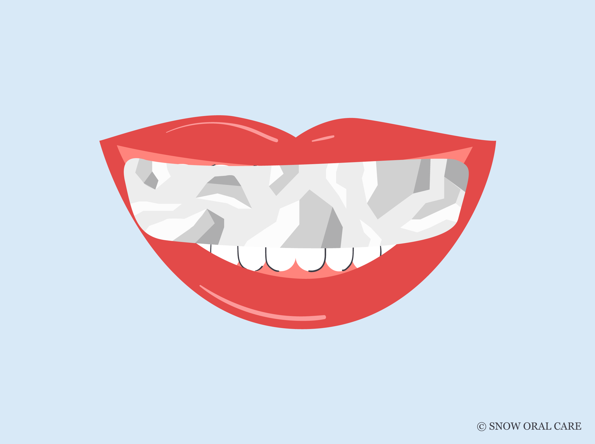 Is Aluminum Foil Teeth Whitening Safe?