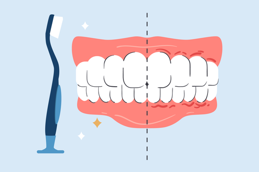 are soft toothbrushes good