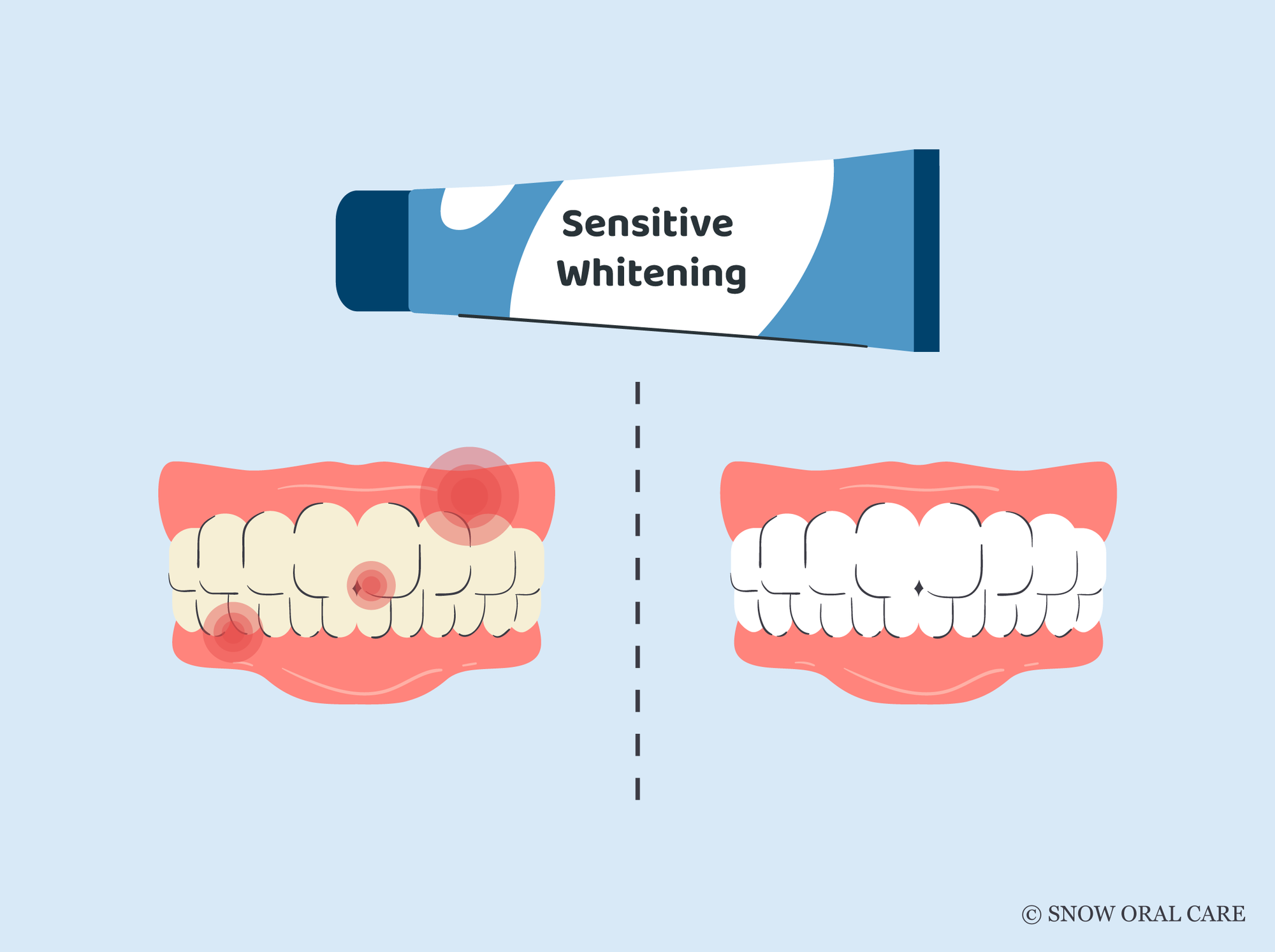 best sensitive whitening toothpaste