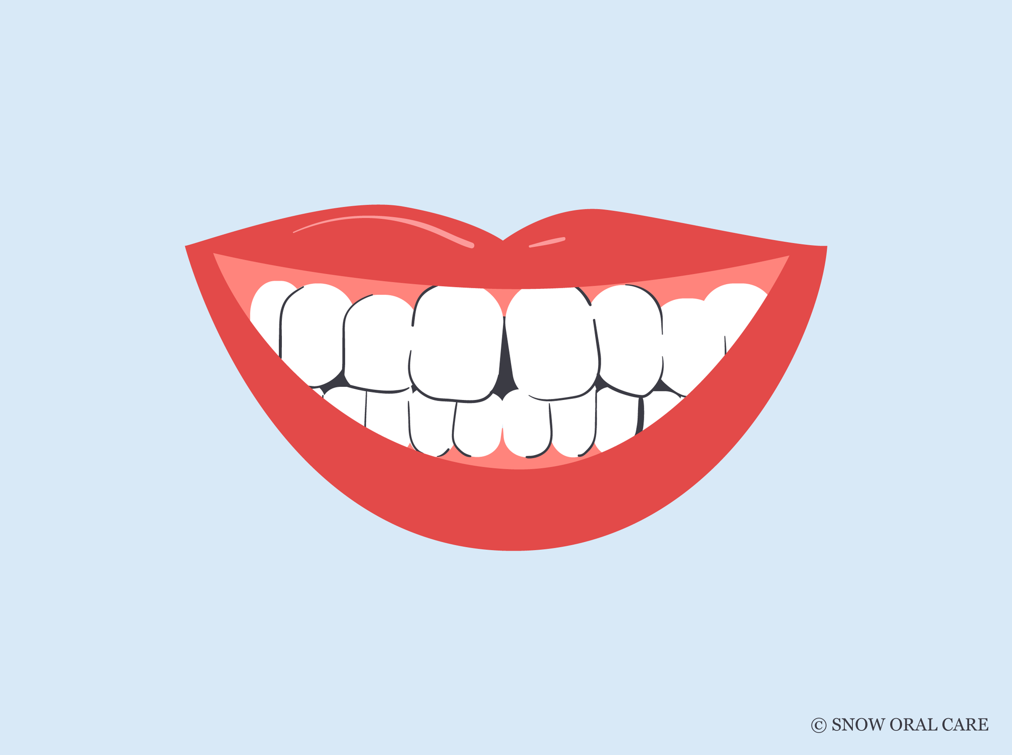 best teeth whitening for crooked teeth 