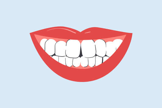 best teeth whitening for crooked teeth 