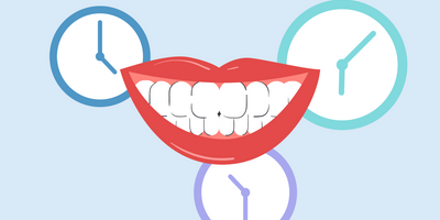 best time to whiten teeth 