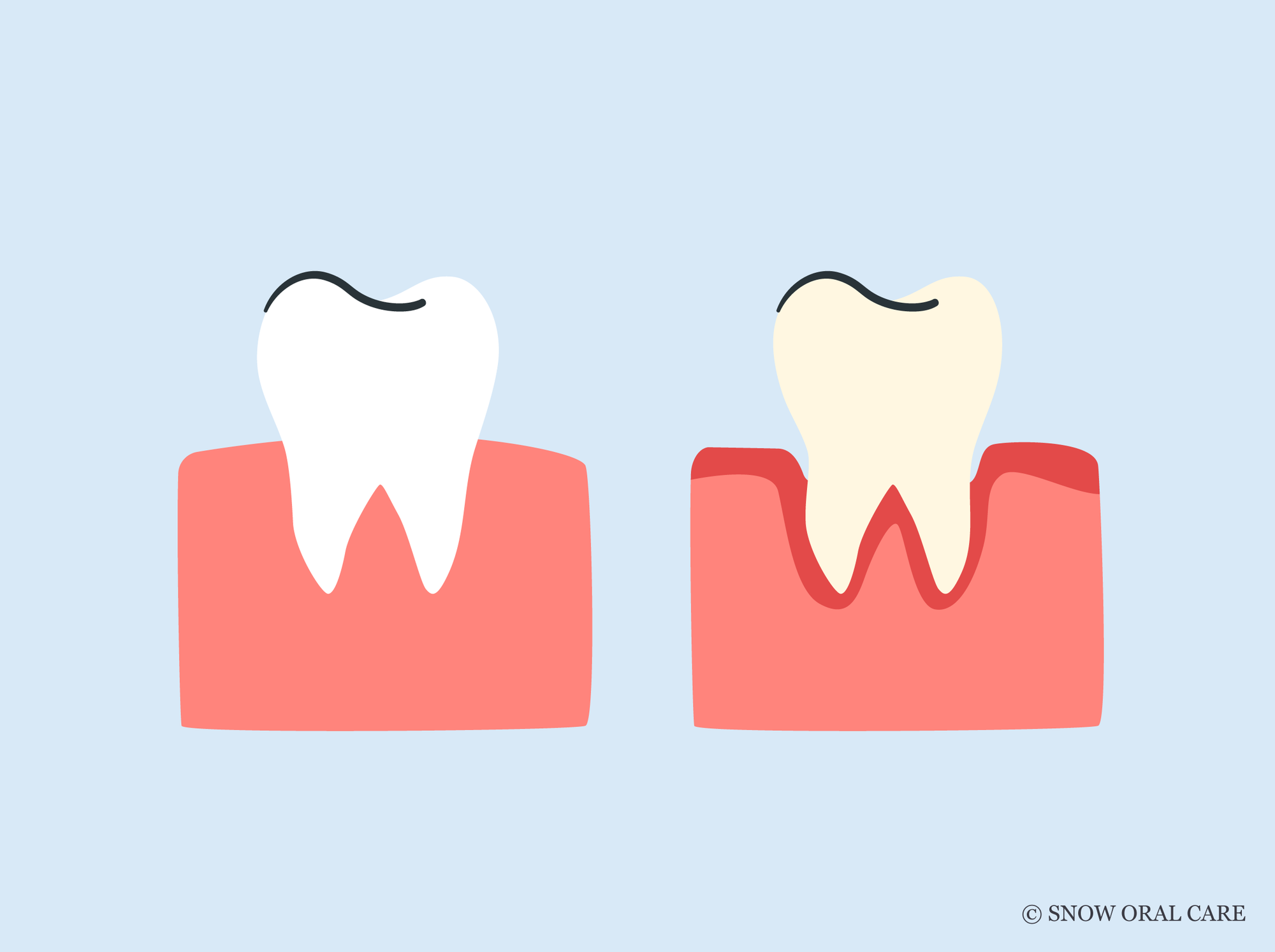 best toothbrush for periodontal disease