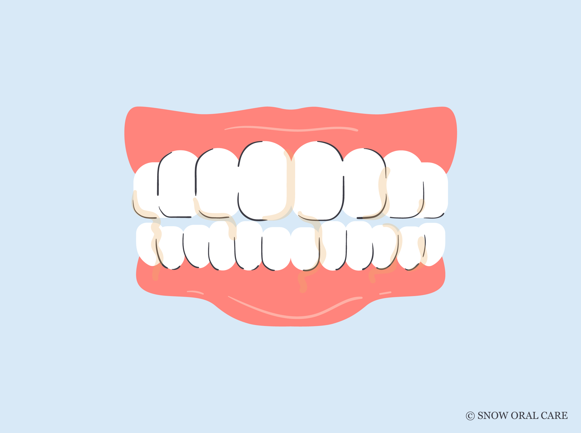 best toothbrush for plaque