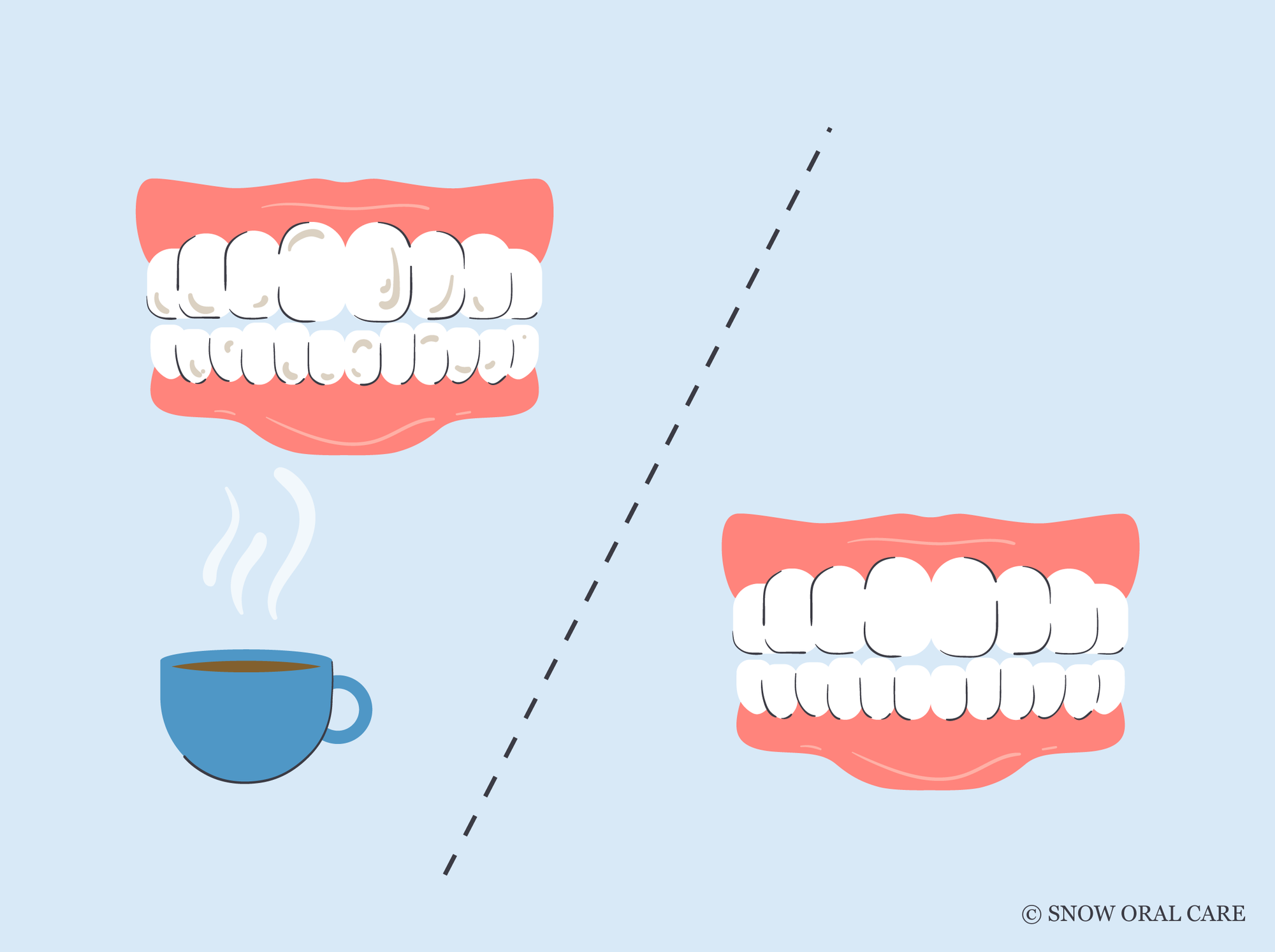best toothpaste for coffee stains