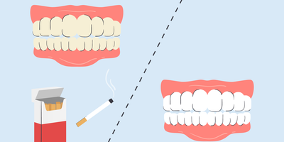 best whitening toothpaste for smokers