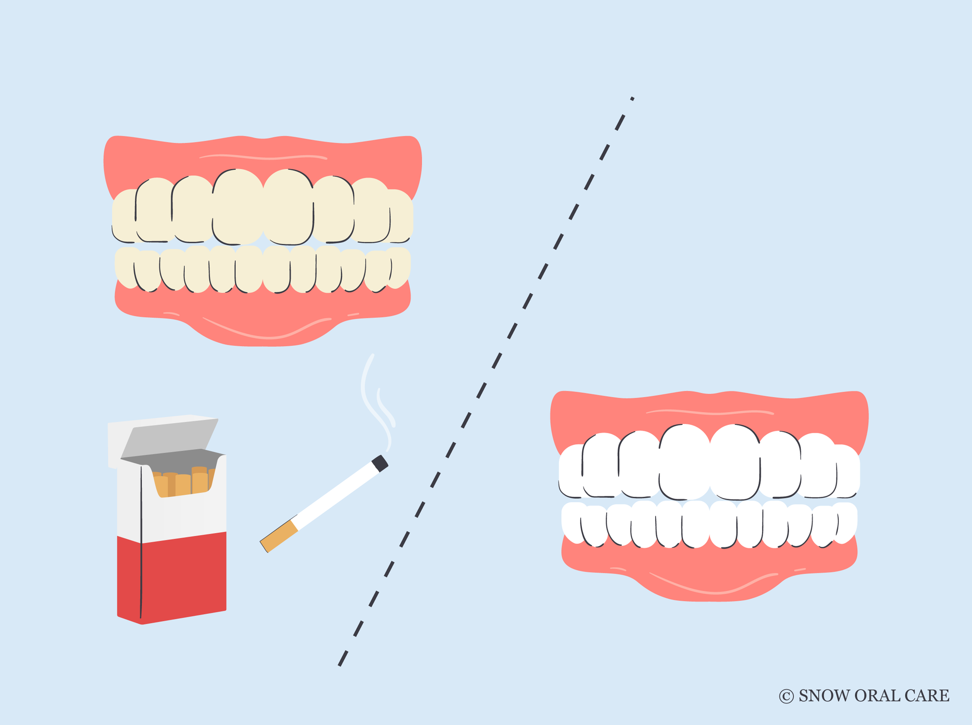 best whitening toothpaste for smokers