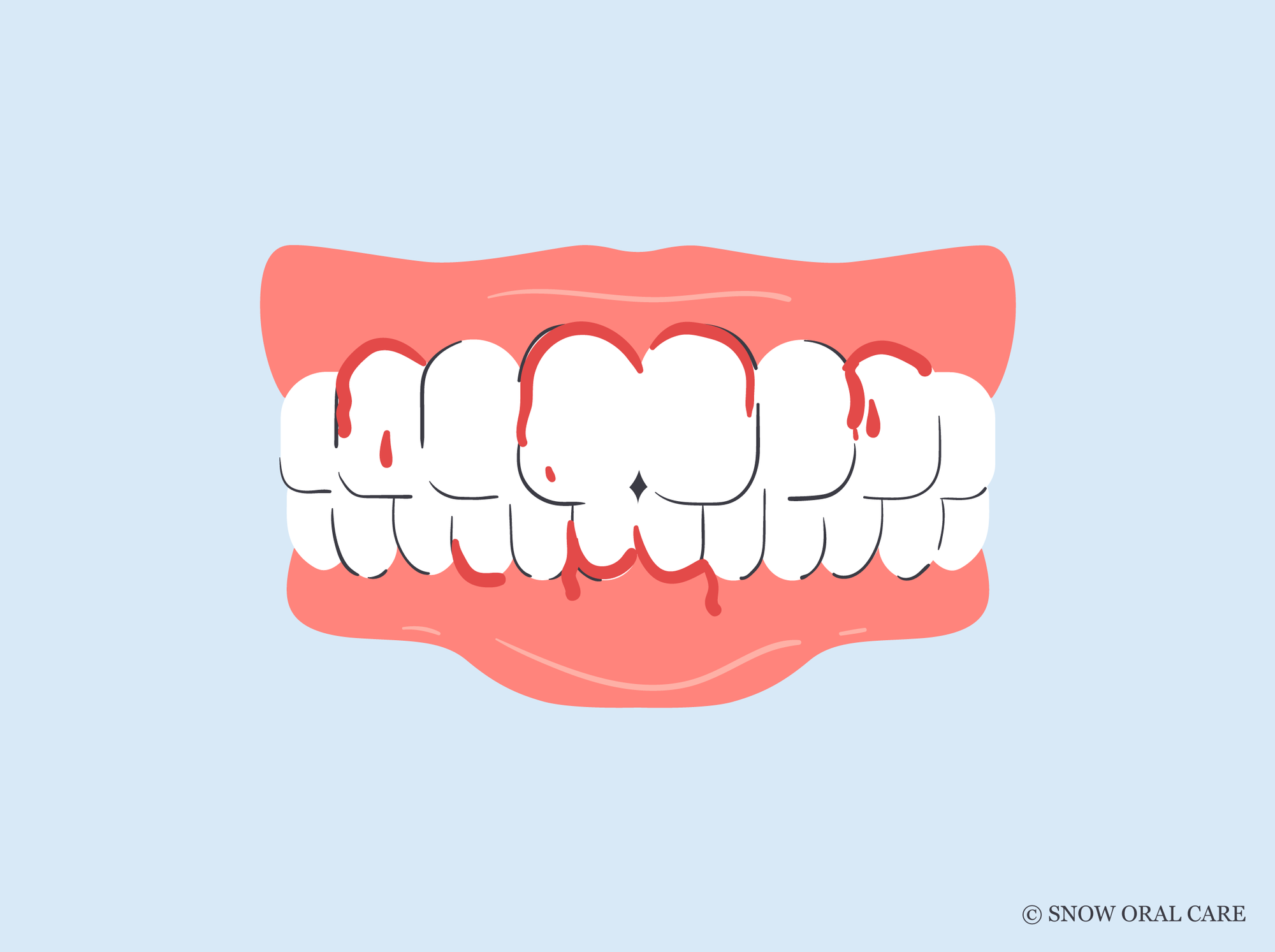blood stains on teeth 