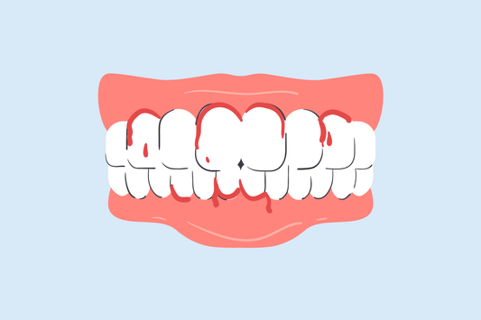 blood stains on teeth 