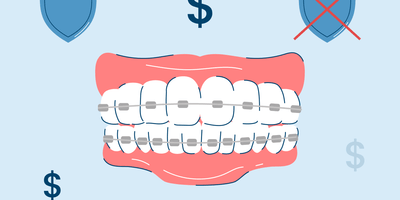 How Much Do Braces Cost? Comprehensive Pricing Guide in 2025