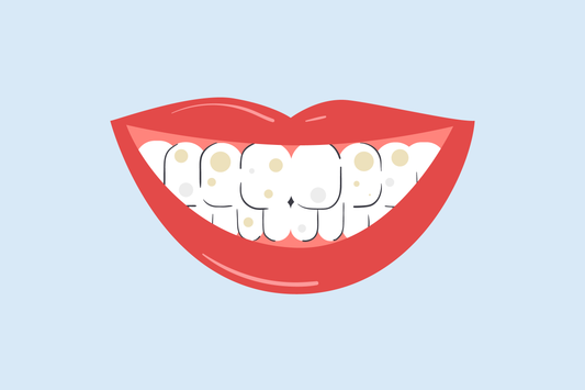 brown and white spots on teeth 