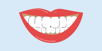 brown gums around teeth 