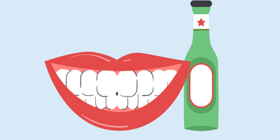 can i drink beer after teeth whitening 
