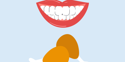 can i eat fried chicken after teeth whitening 