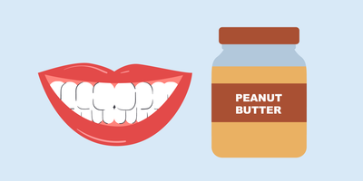 can i eat peanut butter after teeth whitening 