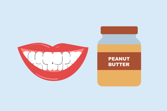 can i eat peanut butter after teeth whitening 