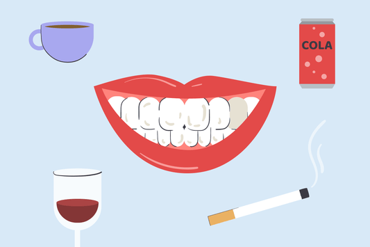 can stained teeth be whitened 