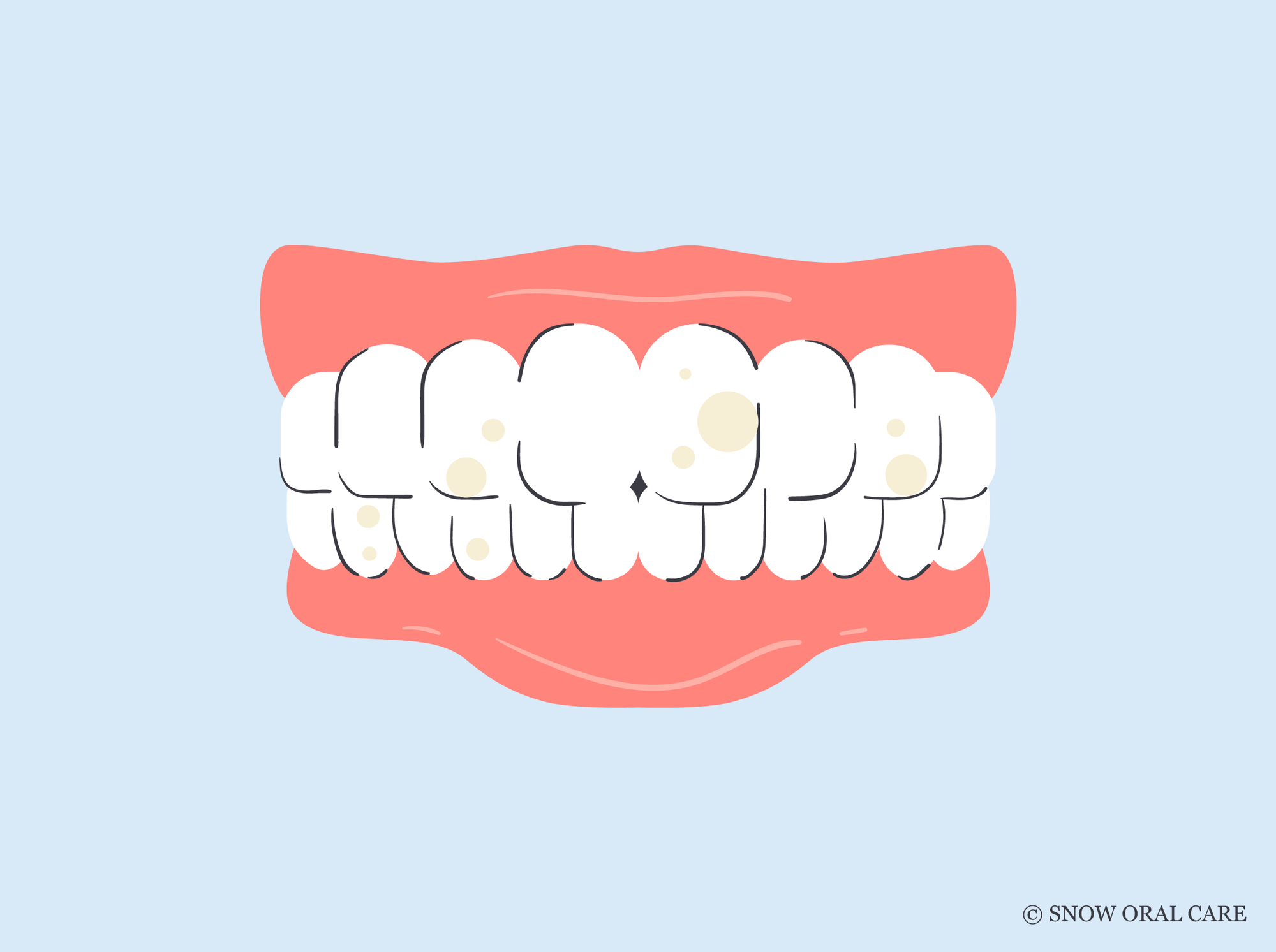 can too much whitening damage teeth 